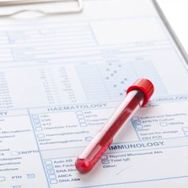 Blood Tests